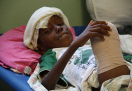 A young amputee, lying on a bed.